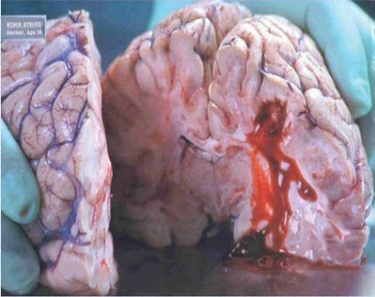 Factors affect to human brain.